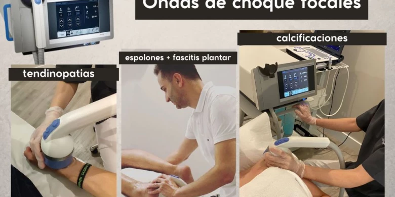 Ondas de choque focales : tecnología de vanguardia para múltiples lesiones