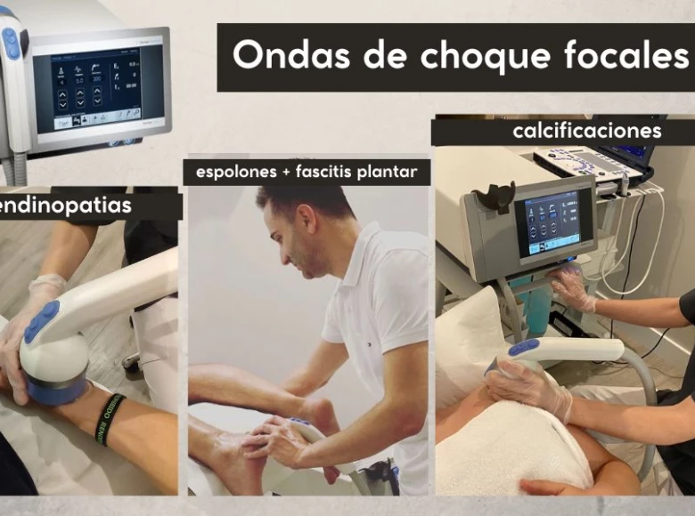 Ondas de choque focales : tecnología de vanguardia para múltiples lesiones